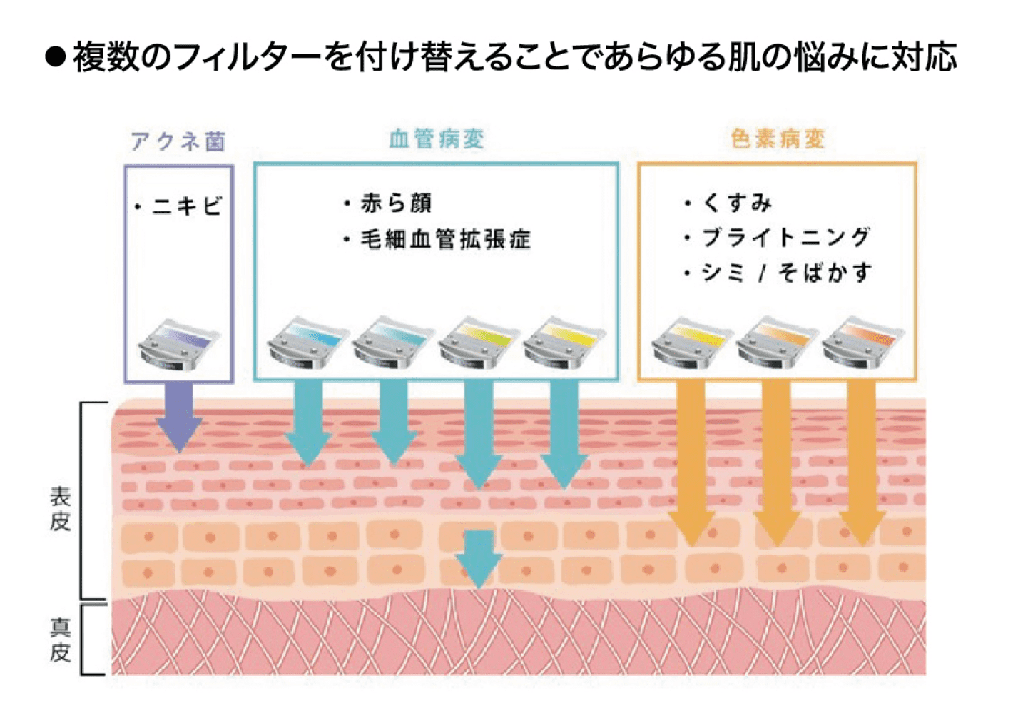 フィルターの説明